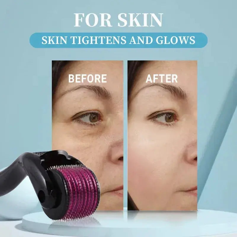 Professional Titanium Derma Roller (540 Needles) - BEAUXUS