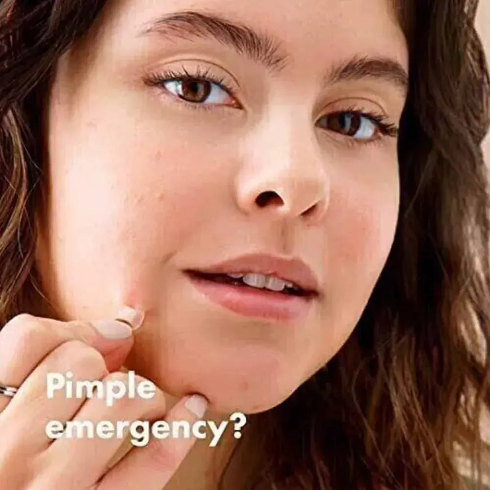 Hero Mighty Patch Hydrocolloid Acne Patches (72 Count) - BEAUXUS