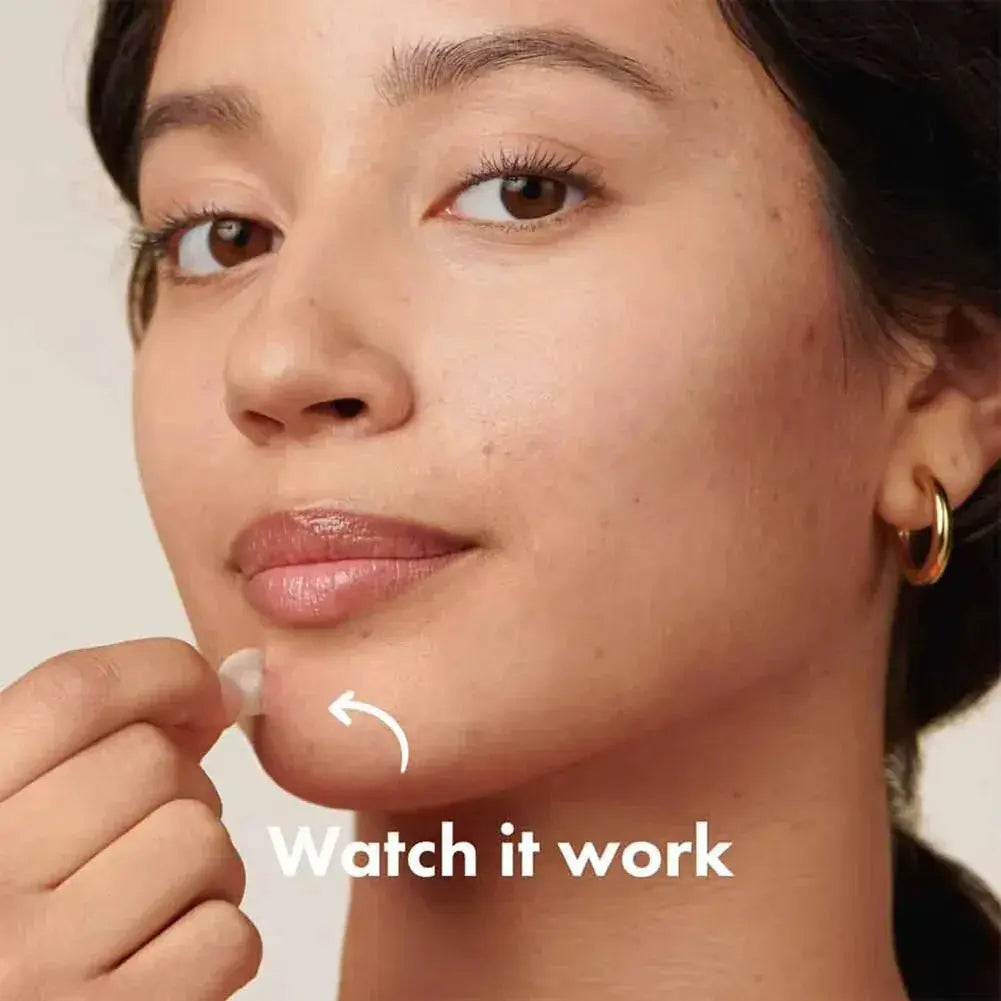 Hero Mighty Patch Hydrocolloid Acne Patches (72 Count) - BEAUXUS